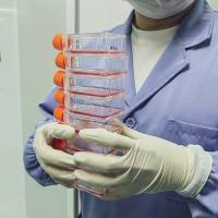 兔子宫内膜间质细胞/兔原代子宫内膜间质细胞