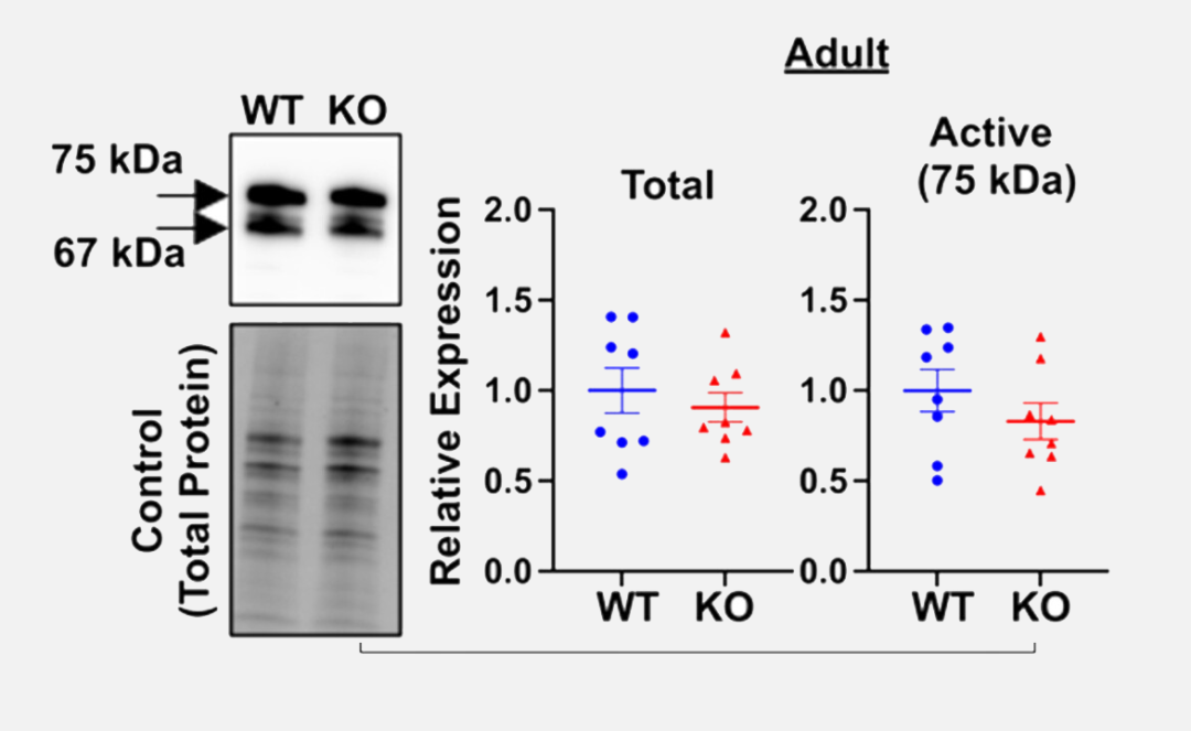脆性X综合征海马体功能障碍