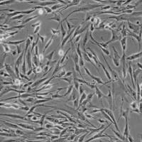  人真皮毛乳头细胞永生化