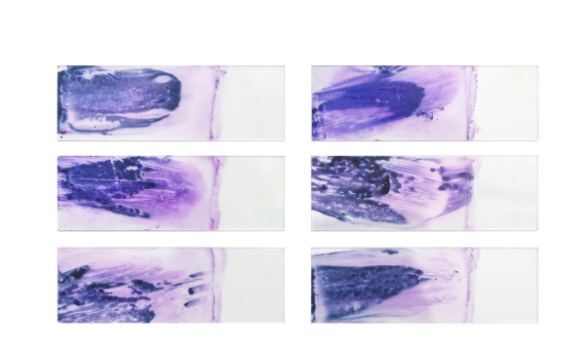 什么是免疫组化中的“重复染色”