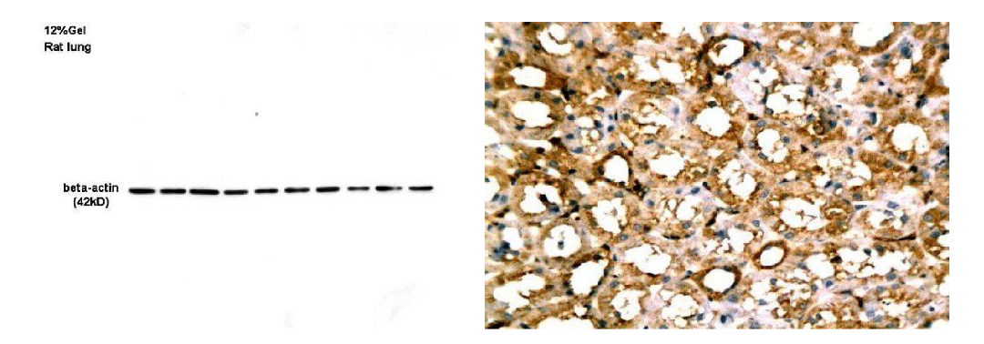 【抗体精选】文献同款：beta Actin 抗体