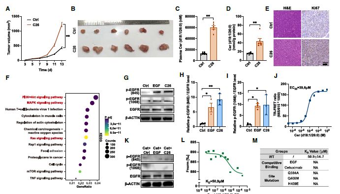 突破结直肠癌治疗新靶点！解析微生物-代谢-肿瘤调控轴