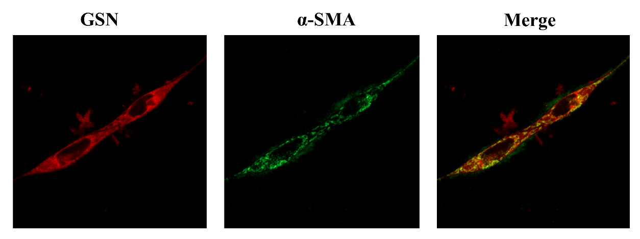 「翘客」技术手册：血管平滑肌细胞GSN/α-SMA免疫荧光双标染色实验方案