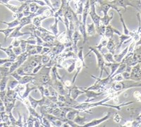 4T1小鼠乳腺癌细胞