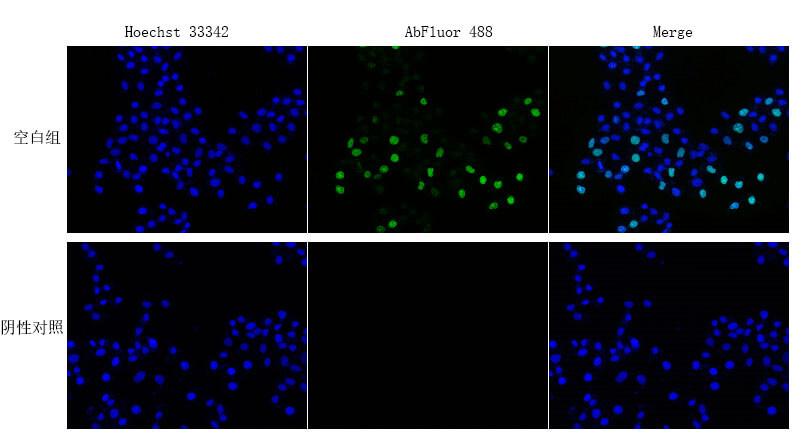 Fig. Proliferating Hela cells detected using Cell Proliferation EdU Image Kit (Green Fluorescence).