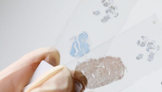 组织活检vs液体活检:精准抗癌的“左膀右臂”