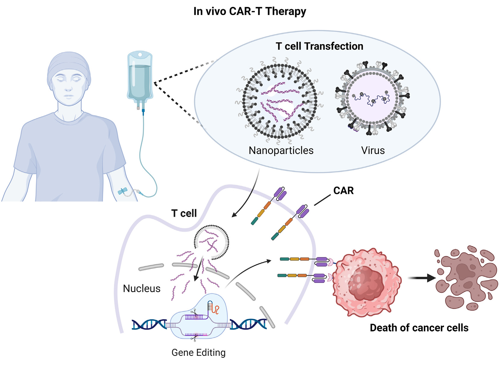 “会发光”的定点标记蛋白：助力体内CAR-T从概念验证突破临床试验研究