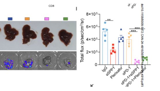 SPP1驱动结直肠癌肝转移的 “密码” 破解！基质胶赋能关键模型构建