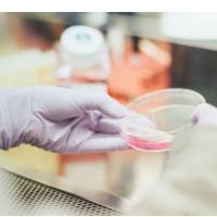 「DIFF  CRO」登革真病毒中和抗体检测