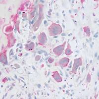 抗酒石酸酸性磷酸酶(TRAP)染色液