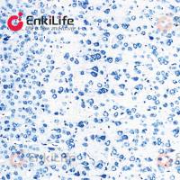 尼氏染色液(甲苯胺蓝法)