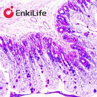 阿利新蓝-过碘suan雪夫(AB-PAS)染色液