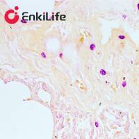 肥大细胞染色液(醛品红-橙黄G法)