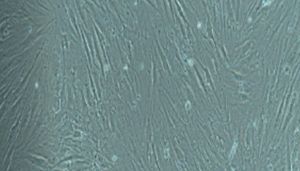 大鼠原代甲状腺成纤维细胞