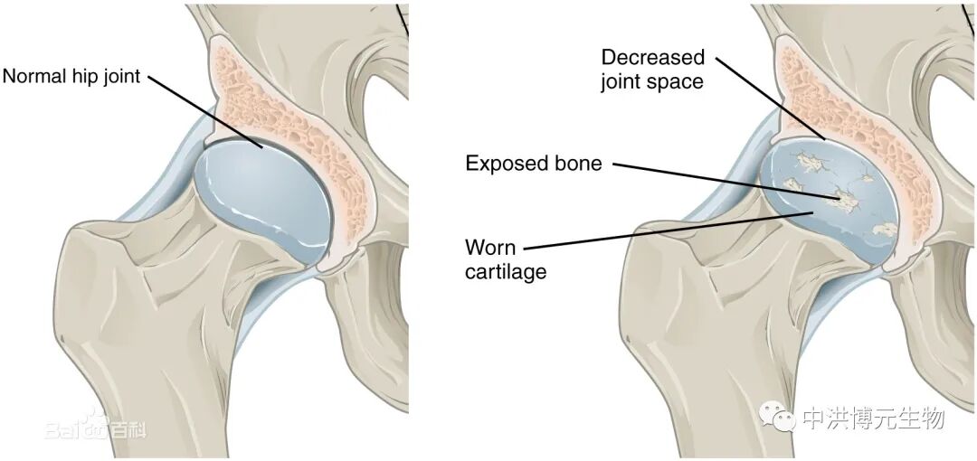 诱发性骨性关节炎模型（OA）