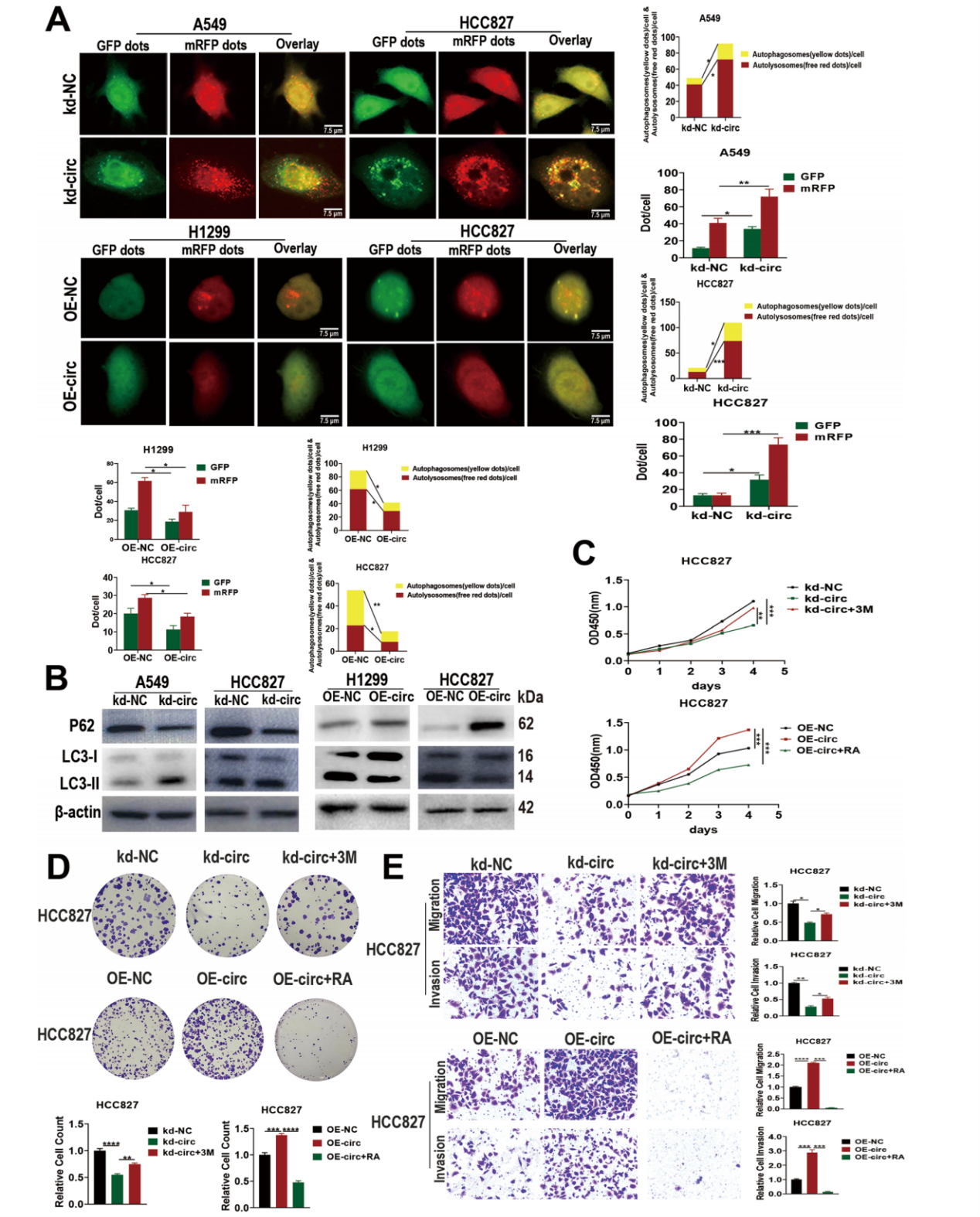 Mol Cancer丨“抑制自噬，加速转移”，解析circRAPGEF5-IGF2BP2-NUP160轴如何助推肺腺癌