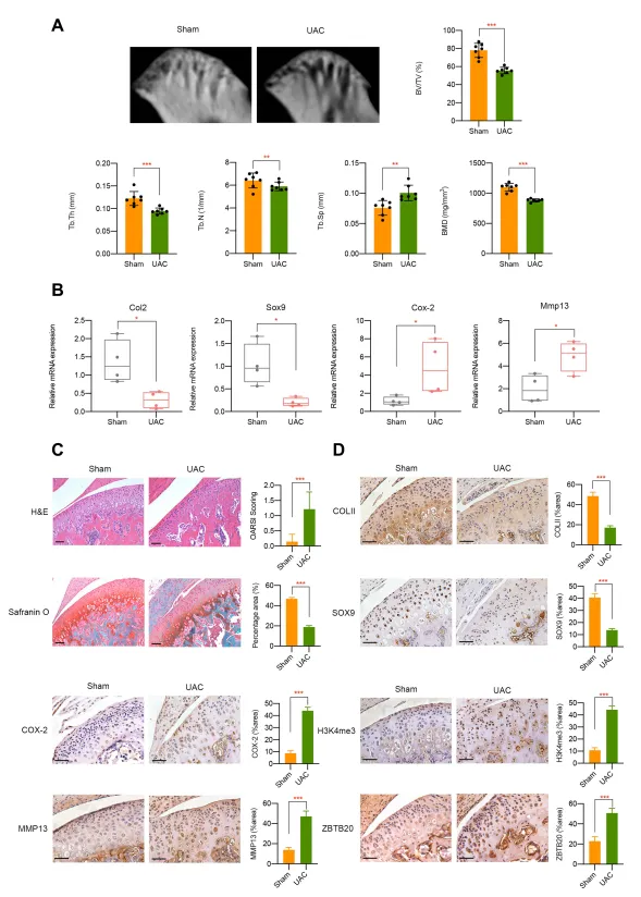 异常流体剪切应力通过 H3K4me3 对 ZBTB20 的表观遗传调控促进关节软骨发病机制