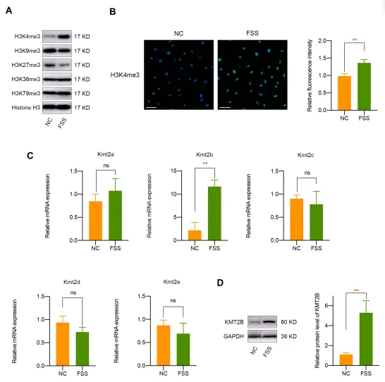 异常流体剪切应力通过 H3K4me3 对 ZBTB20 的表观遗传调控促进关节软骨发病机制