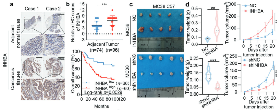 文献解读丨IF=52.7！抑制素β A通过巨噬细胞M2极化和线粒体依赖性铁死亡抑制驱动结直肠癌的进展