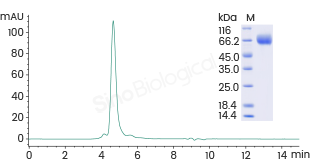 尼帕病毒（NiV）抗原及抗体试剂