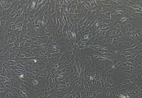 猪主动脉内皮细胞永生化/真皮毛乳头细胞/NK细胞