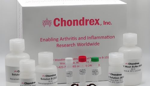 肥大细胞活化和脱颗粒的标志物检测-小鼠单核细胞趋化蛋白-1（MCP-1）ELISA 试剂盒