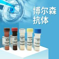 Anti-Nipah virus/HeV G protein/Glycoprotein G Polyclonal Antibody