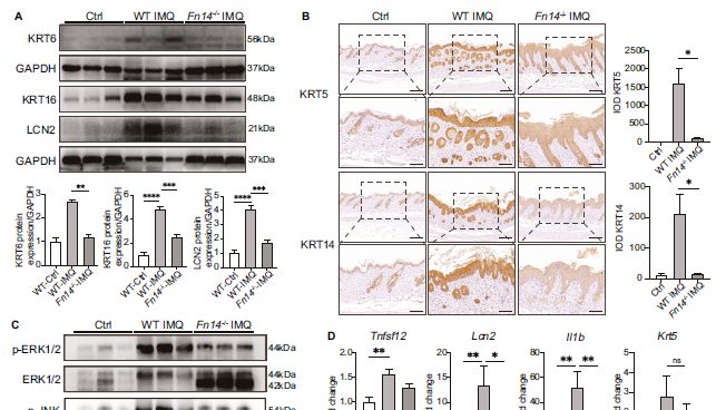 聚焦银屑病机制研究！解析LCN2-TWEAK-Fn14协同调控网络