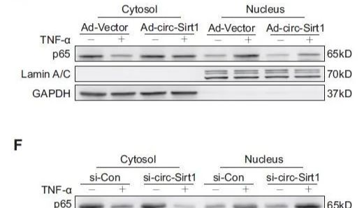 细胞核蛋白总是提不干净？可能是裂解方法选错了！