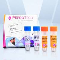 Recombinant Murine gAcrp30（25ug）