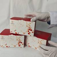 土壤脂肪酶（Solid-Lipase，S-LPS）活性试剂盒