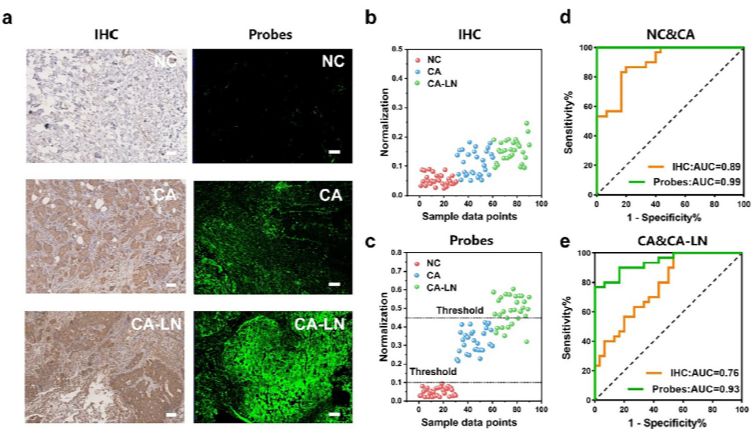 突破乳腺癌转移诊断瓶颈！钙钛矿探针实现高对比度成像