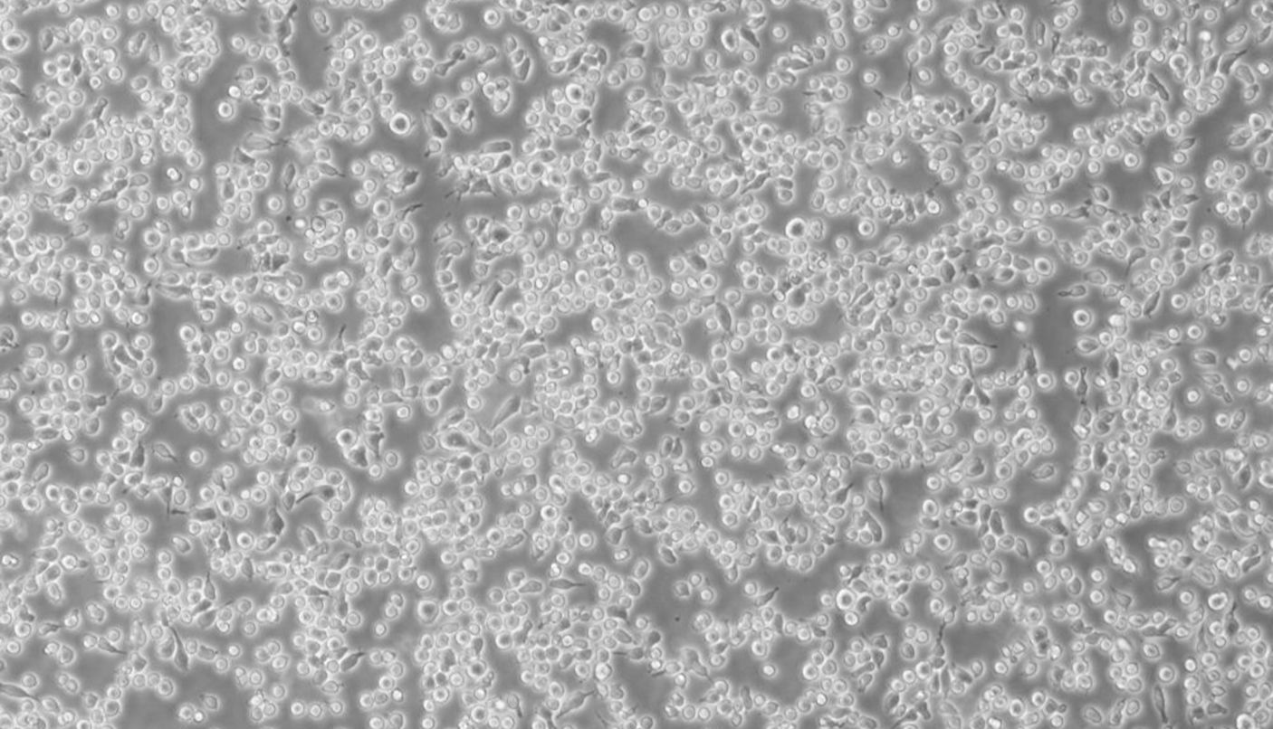 细胞攻略 | MM.1S(人多发性骨髓瘤细胞)培养教程