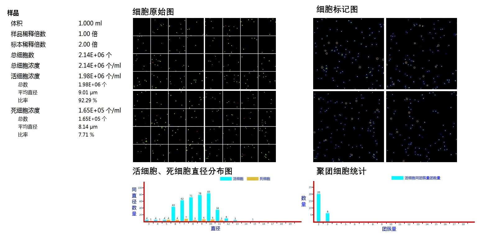 人外周血淋巴细胞分离液 Human Peripheral Blood Lymphocyte Separation Medium