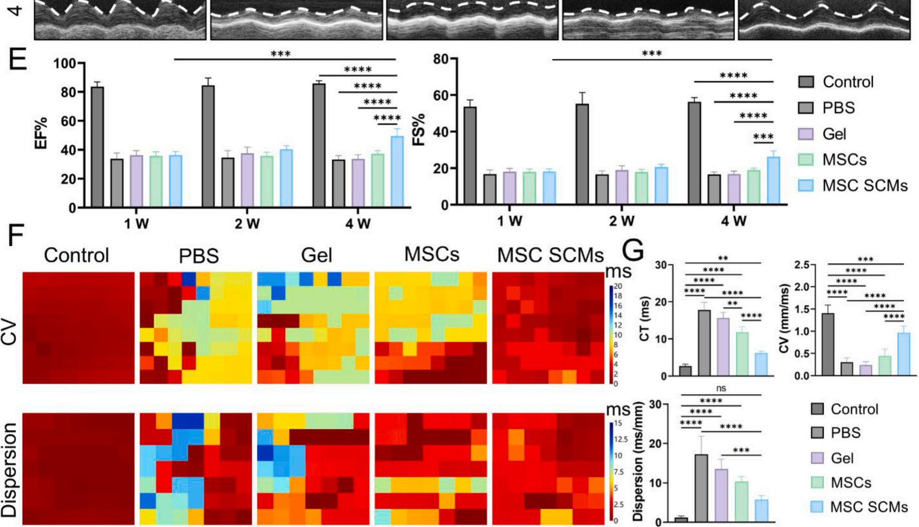 Bioactive Materials（IF：20.3)：生物酶法单细胞微囊化技术 — 优化干细胞治疗的新策略