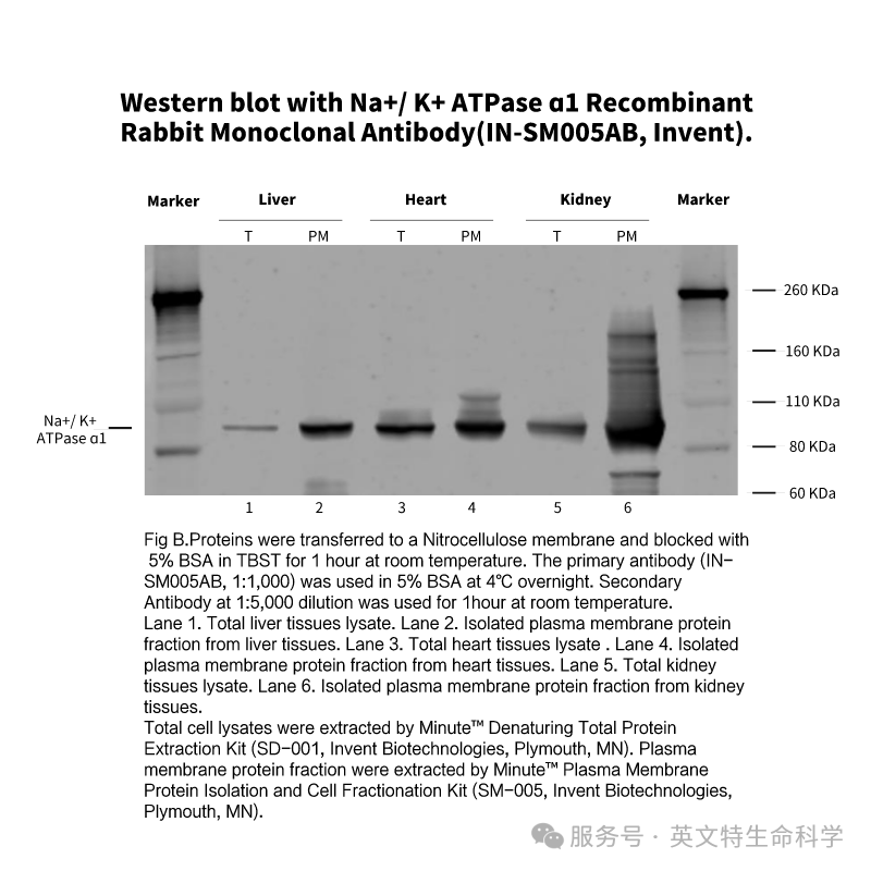 细胞膜蛋白WB避坑指南：选对内参，你的结果才值得信赖！