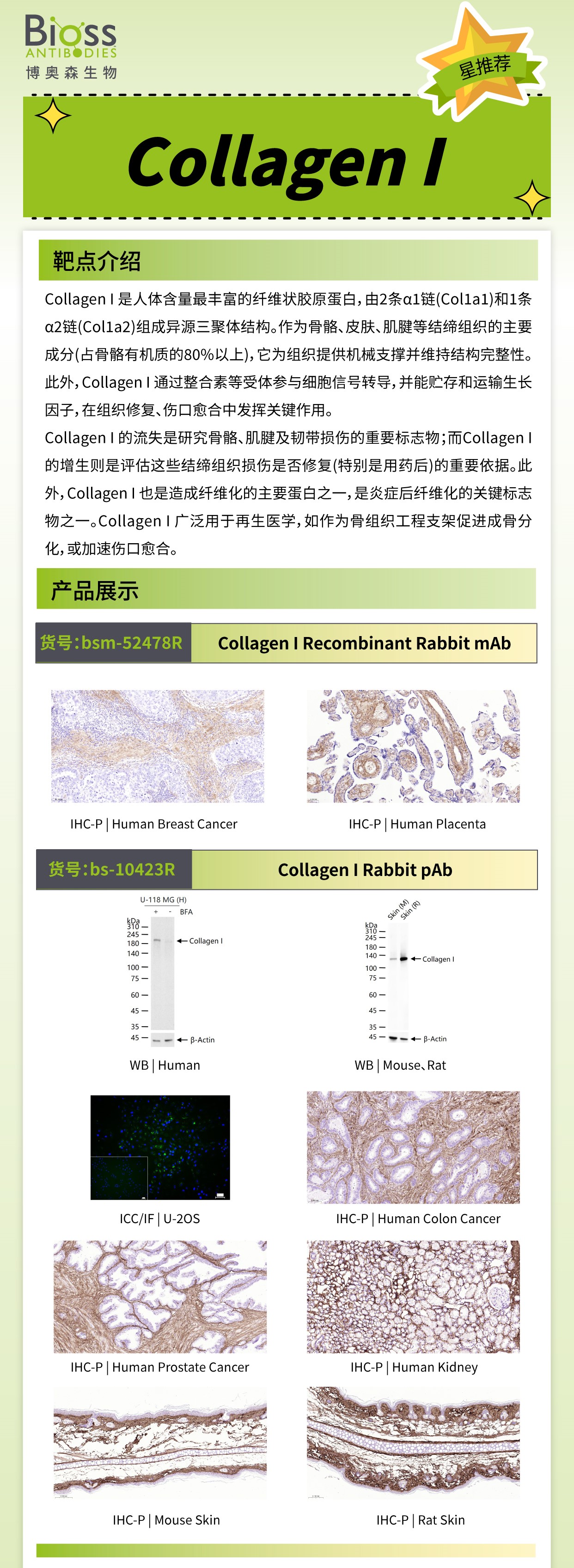博奥森星推荐 | Collagen I 抗体