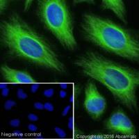 山羊抗兔lgG H&L(Alexa Fluor® 488)(ab150077)Abcam/艾博