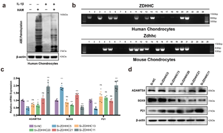 Nature Aging | 棕榈酰化修饰如何守护软骨、对抗骨关节炎？锁定ZDHHC11的关键机制