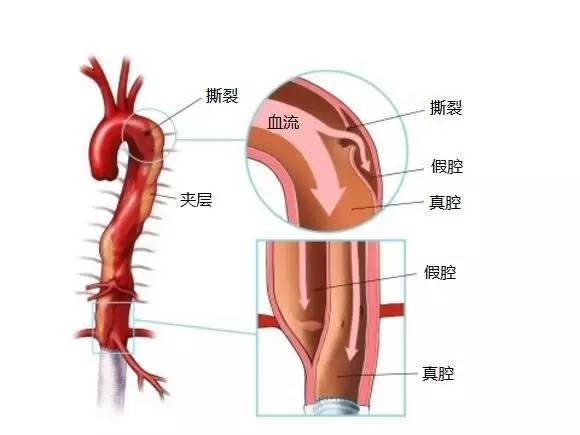 病理小课堂：循环系统血管的结构与功能