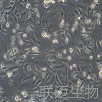 MDA-MB-231【人乳腺癌细胞】