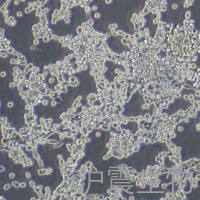 LLC(小鼠肺癌细胞)