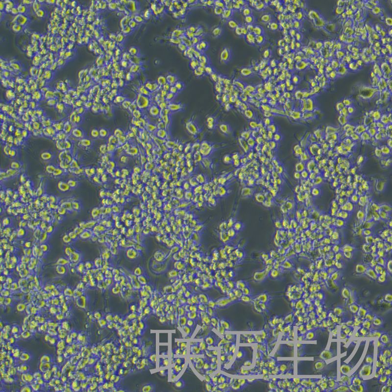 MFC细胞(小鼠胃癌细胞)