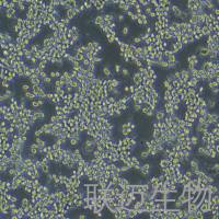 MFC细胞（小鼠胃癌细胞）