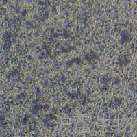 CT-26(小鼠结肠癌细胞)