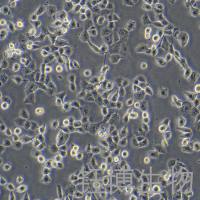 PANC-1（人胰腺癌细胞）YB-71184HC
