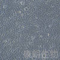 HTMC（人小梁网细胞） 