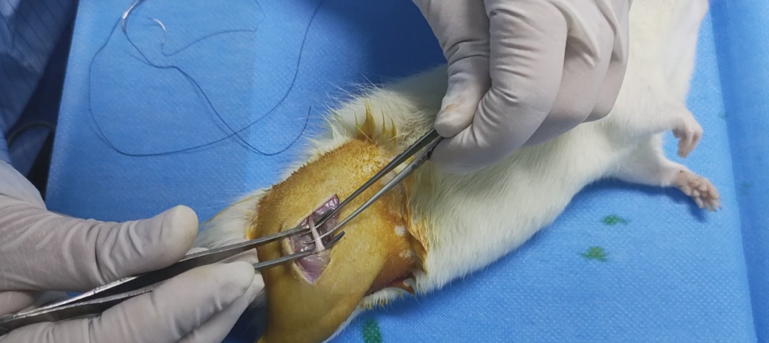 别怕，MDL来解决疼痛研究的“痛”点！