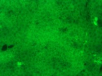 4T1-LUC-GFP-Puro[4T1-LUC;4T1-GFP]双标记的小鼠乳腺癌细胞