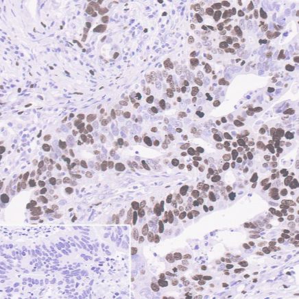 Abcam/艾博抗	ab16667	重组Anti-Ki67抗体[SP6]